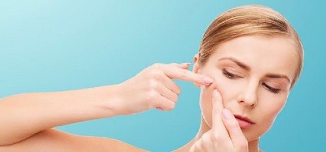 Basic Tips For Acne Treatment