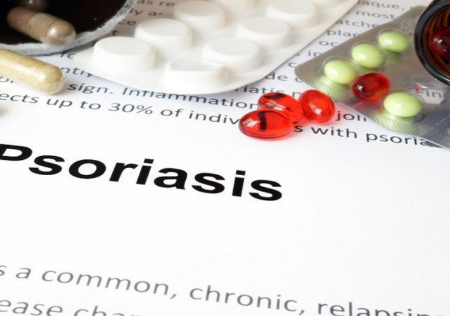Tips To Manage Psoriasis Without Drugs